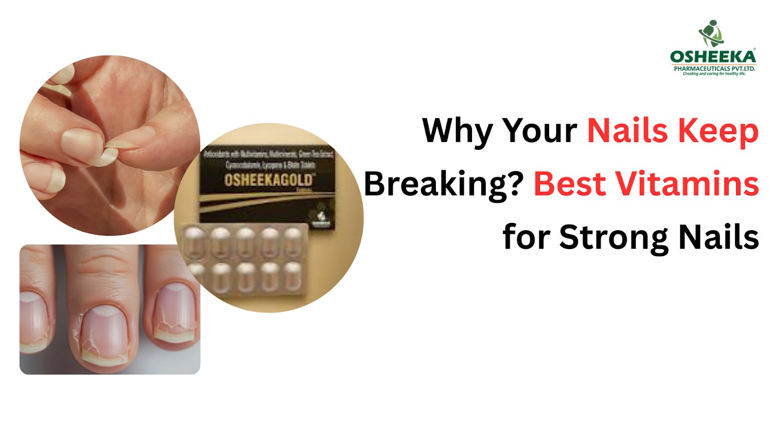 Why Your Nails Keep Breaking? Best Vitamins for Strong Nails